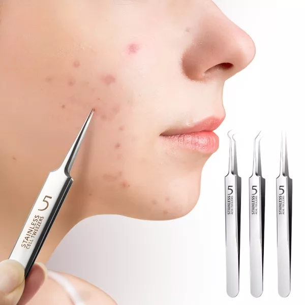 blackhead tweezers, blackhead remover, blackhead removal kit