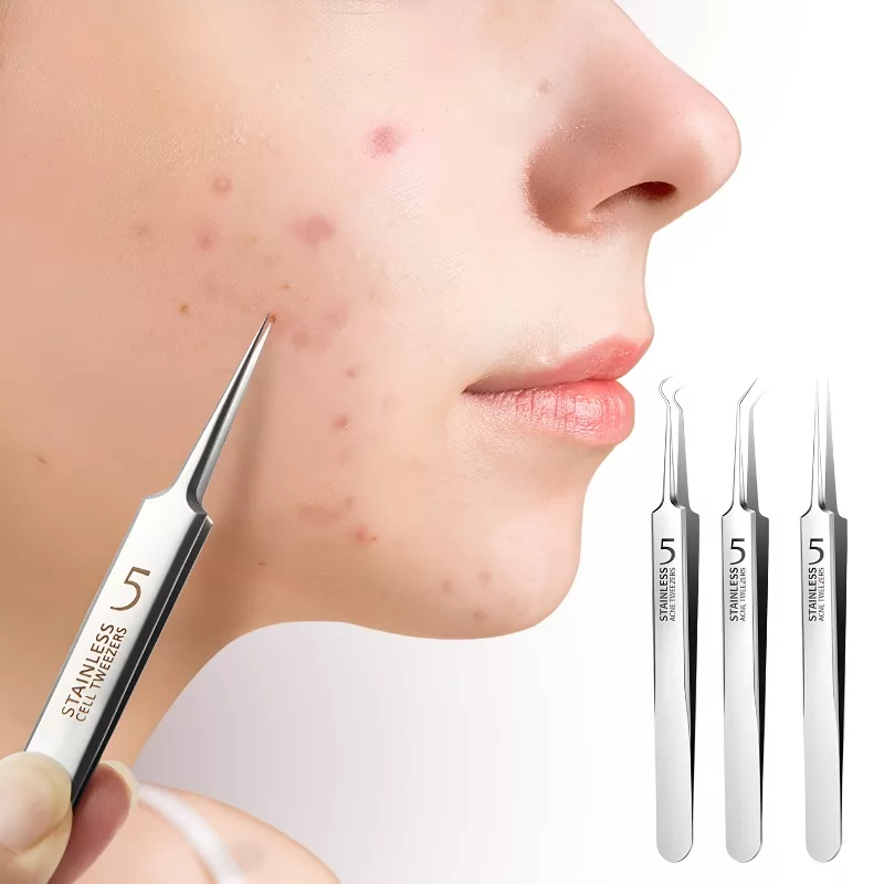 blackhead tweezers, blackhead remover, blackhead removal kit